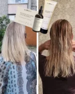 Aurodhea pret matu izkrišanas komplekss FA01B - Image 5