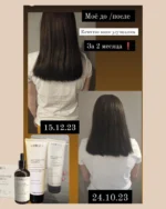 Aurodhea šampūns pret matu izkrišanu 250ml CAP12B - Image 2
